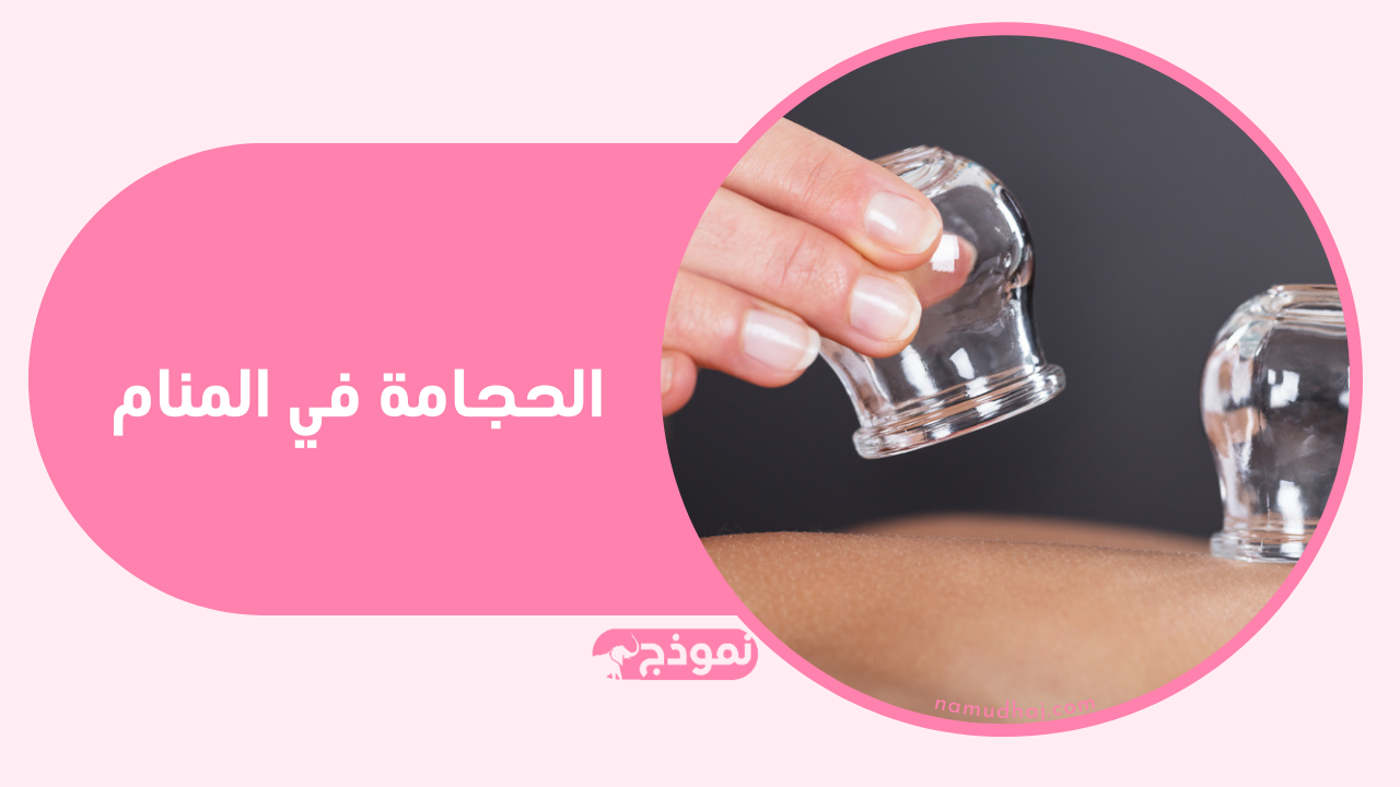 الحجامة في المنام