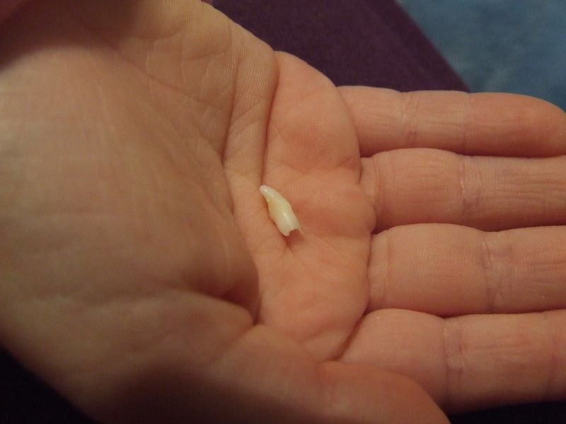 سقوط الأسنان في اليد معناه، خسارة تعوض